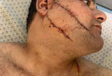 الاعتداء على الدكتور احمد عبد ربه