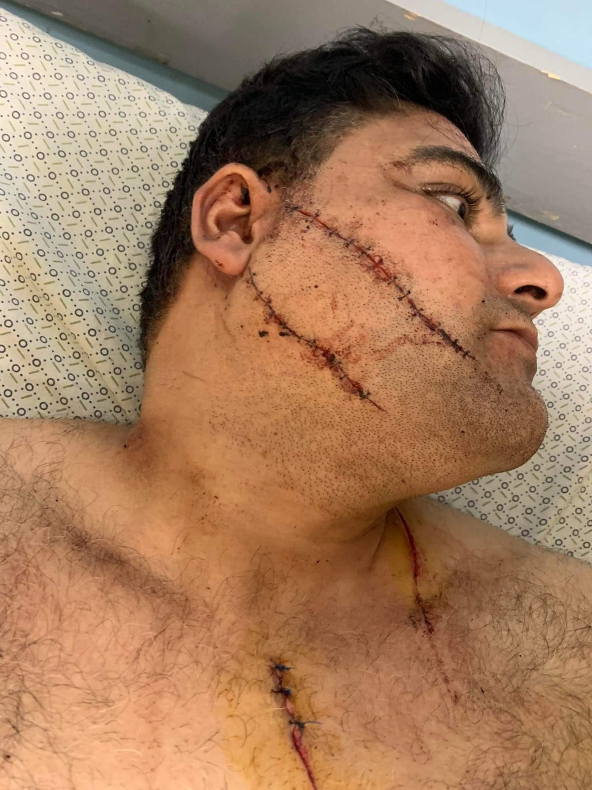 الاعتداء على الدكتور احمد عبد ربه